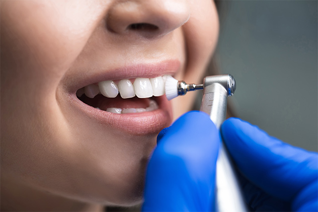 Die Anwendung der Bürste als Werkzeug zur professionellen Zahnreinigung