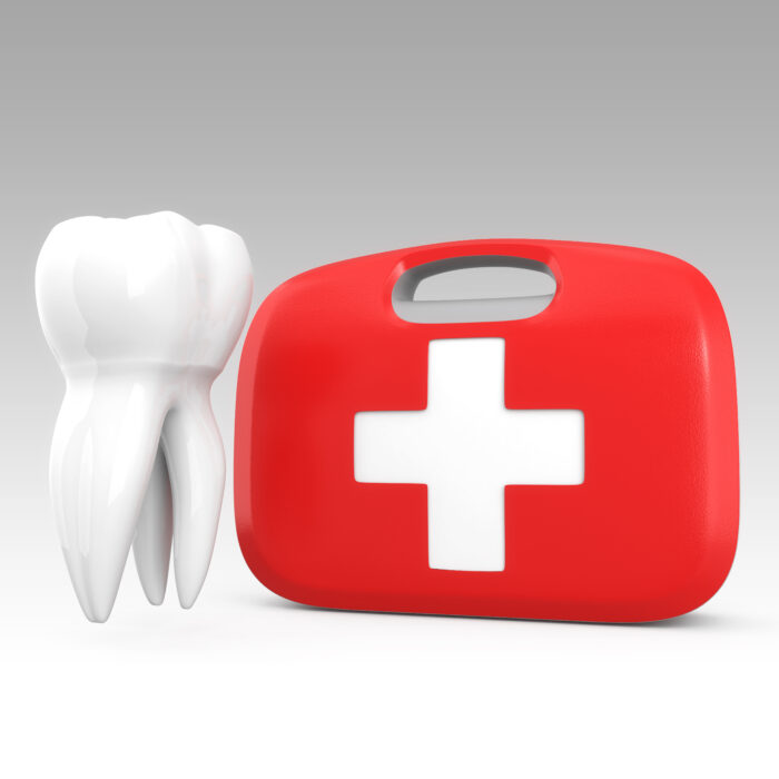 Wichtig ist es, dass Sie den Zahnunfall sofort ihrer Zahnarztpraxis melden.